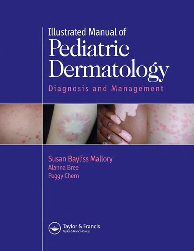 Handbook of pediatric dermatology