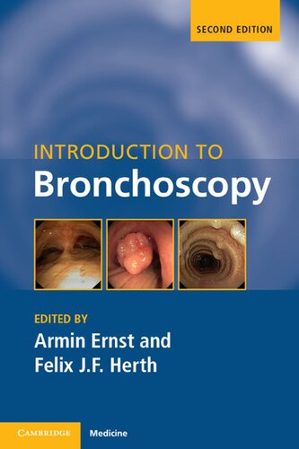 Introduction to bronchoscopy