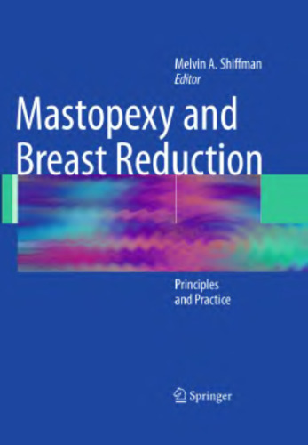 Mastopexy and Breast Reduction: Principles and Practice