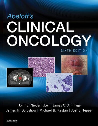Abeloff's clinical oncology