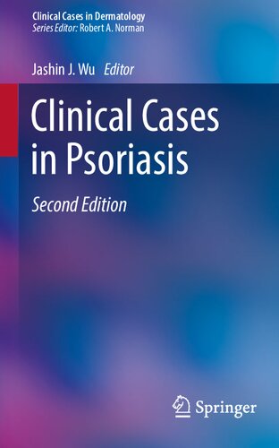 Clinical cases in psoriasis