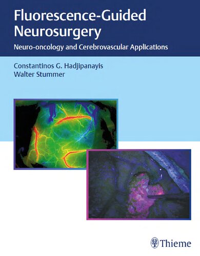 Fluorescence-guided neurosurgery neuro-oncology and cerebrovascular applications