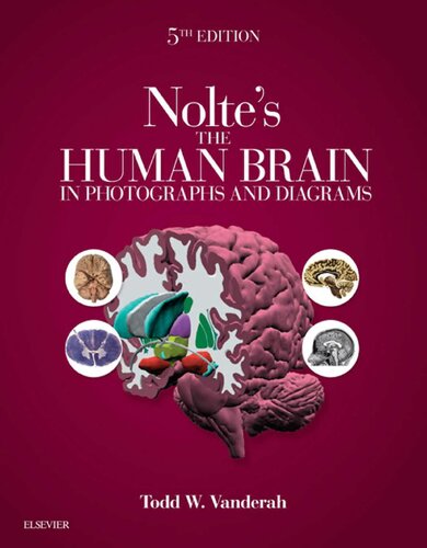 Nolte's The Human Brain in Photographs and Diagrams, 5e: With STUDENT CONSULT Online Access