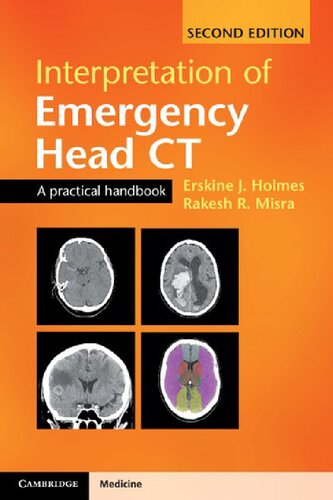 Interpretation of emergency head CT. A practical handbook