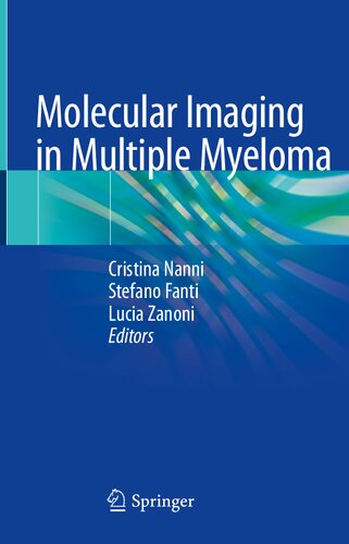 Molecular imaging in multiple myeloma