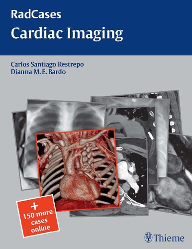 Radcases cardiac imaging