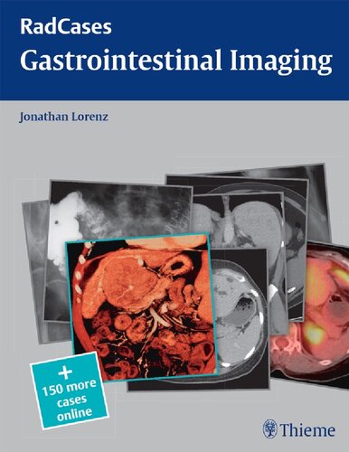 Gastrointestinal imaging