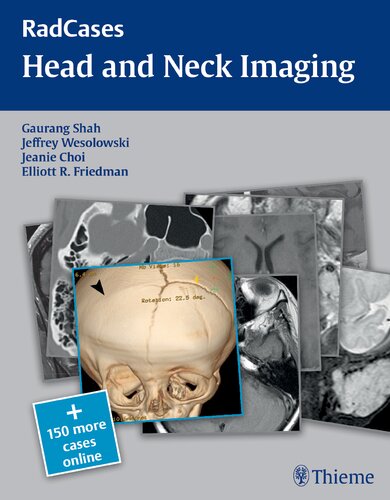 Head and neck imaging