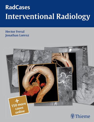 Interventional radiology