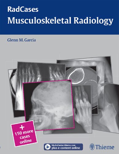 musculoskeletal radiology.