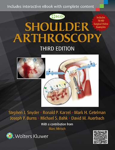 Shoulder arthroscopy.