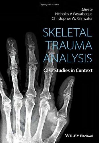 Skeletal trauma analysis : case studies in context