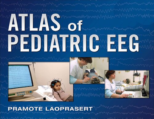 Atlas of pediatric EEG