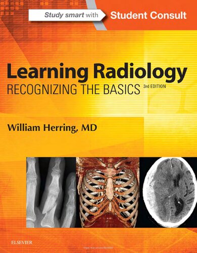Learning radiology : recognizing the basics