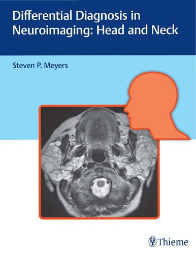 Differential diagnosis in neuroimaging. Head and neck