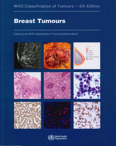 Breast Tumours: WHO Classification of Tumours