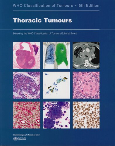 Thoracic Tumours: WHO Classification of Tumours [, &nbsp;ed.]  928324067, 978928324063