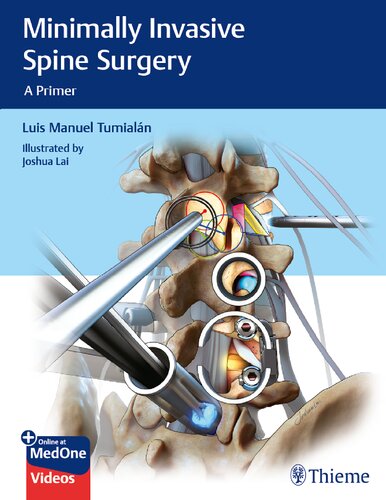 Minimally Invasive Spine Surgery: A Primer