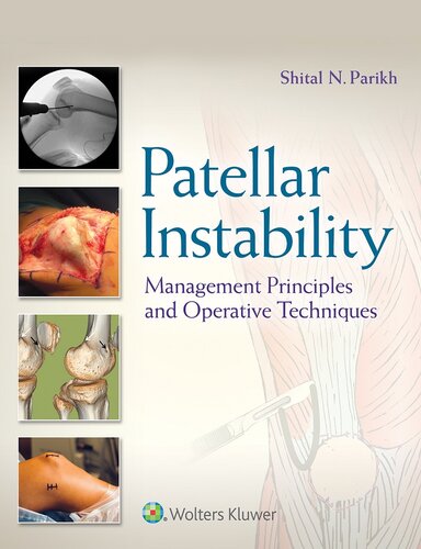 Patellar Instability: Management Principles and Operative Techniques