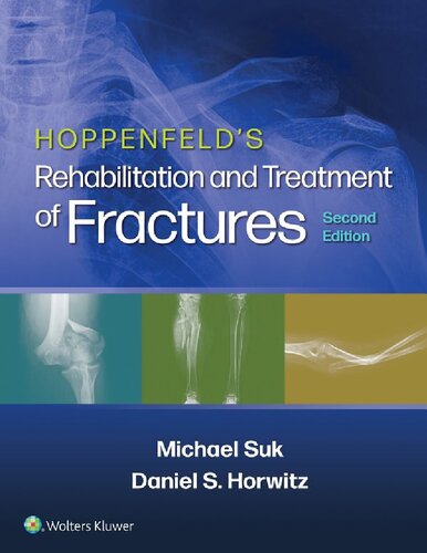 Hoppenfeld's treatment and rehabilitation of fractures