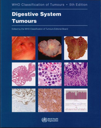 Digestive System Tumours: WHO Classification of Tumours [, 5&nbsp;ed.]