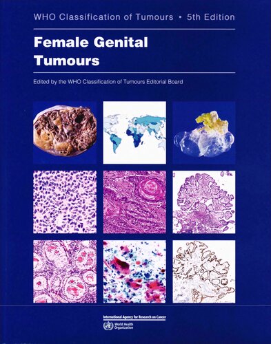 Female Genital Tumours: WHO Classification of Tumours