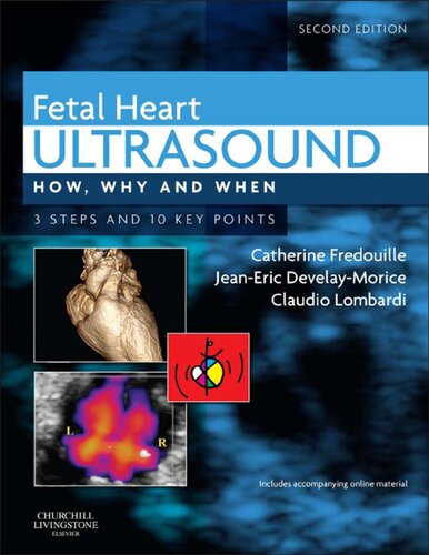 Fetal heart ultrasound : how, why, and when. 3 steps and 10 key points