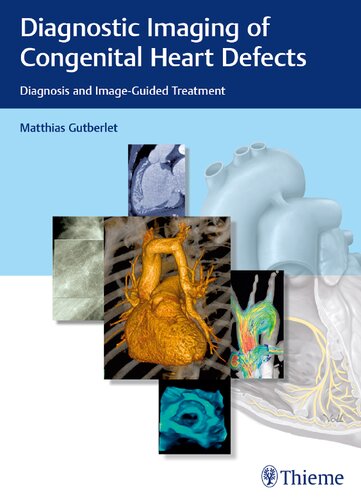 Diagnostic imaging of congenital heart defects : diagnosis and image-guided treatment