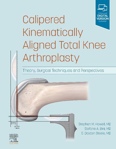 Calipered Kinematically aligned Total Knee Arthroplasty: Theory, Surgical Techniques and Perspectives