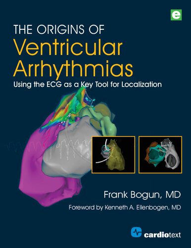 The Origins of Ventricular Arrhythmias: Using the ECG as a Key Tool for Localization