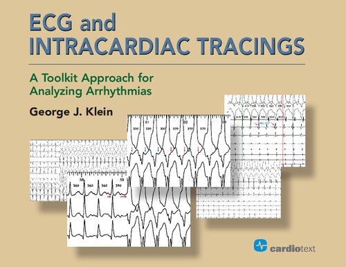 ECG and Intracardiac Tracings: A Toolkit Approach for Analyzing Arrhythmias