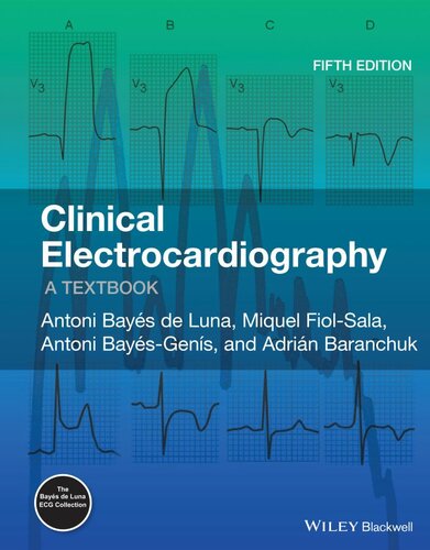 Clinical Electrocardiography: A Textbook