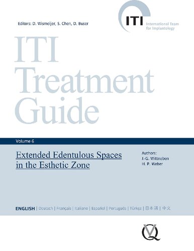 ITI Treatment Guide, Vol 6: Extended Edentulous Spaces in the Esthetic Zone (ITI Treatment Guides)