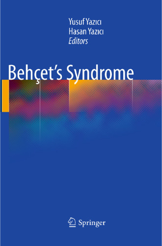 Behçet’s Syndrome