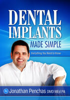 Dental Implants Made Simple
