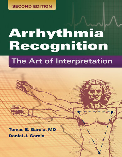 Arrhythmia Recognition: The Art of Interpretation: The Art of Interpretation