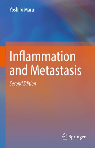 Inflammation and Metastasis