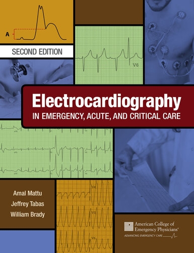 Electrocardiography in Emergency, Acute, and Critical Care