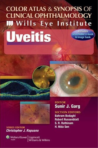 Uveitis: Color Atlas and Synopsis of Clinical Ophthalmology (Wills Eye Institute Atlas Series)