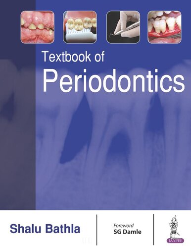 Textbook of Periodontics
