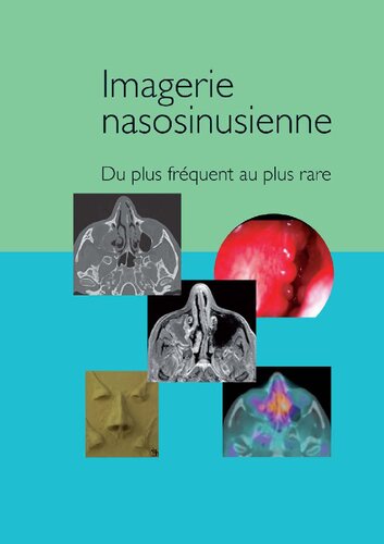 Imagerie nasosinusienne - du plus fréquent au plus rare ( Lemanip.com )