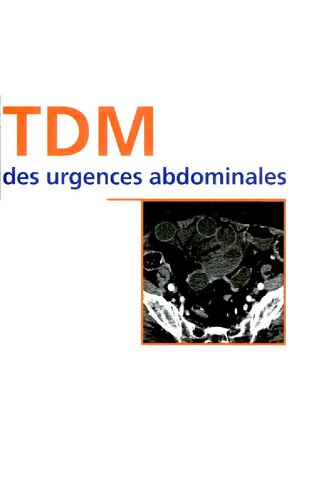 TDM des urgences abdominales (Imagerie médicale : formation) (French Edition)