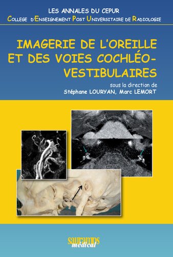 Imagerie de l'oreille et des voies cochléo-vestibulaires