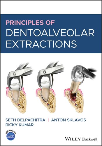Principles of Dentoalveolar Extractions