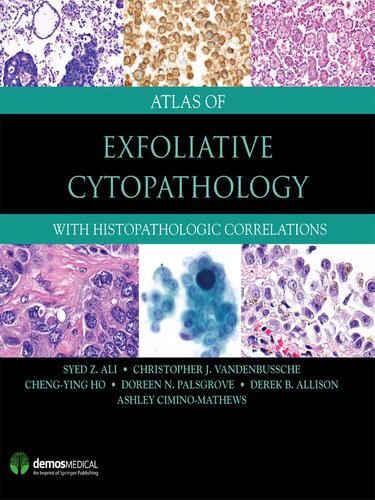 Atlas of Exfoliative Cytopathology: With Histopathologic Correlations