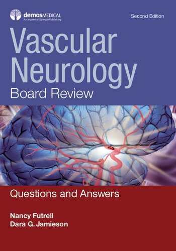 Vascular neurology board review : questions and answers