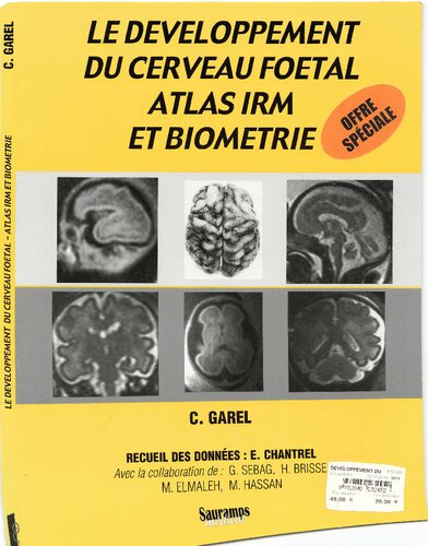 Le développement du cerveau foetal : atlas IRM et biométrie