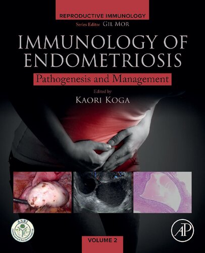 Immunology of Endometriosis: Pathogenesis and Management
