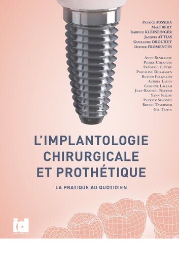 L'implantologie chirurgicale et prothétique: La pratique au quotidien