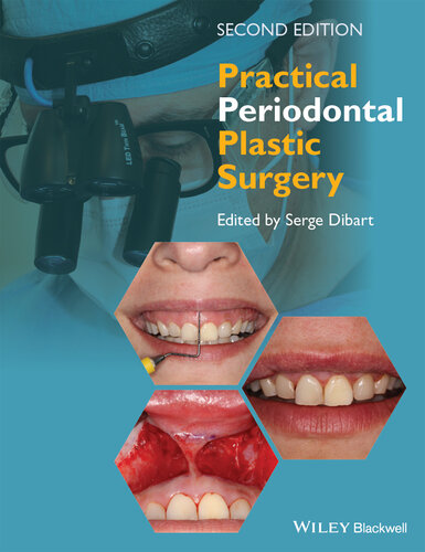Practical Periodontal Plastic Surgery